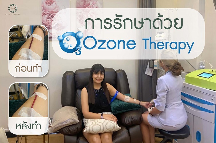 OZONE THERAPY
