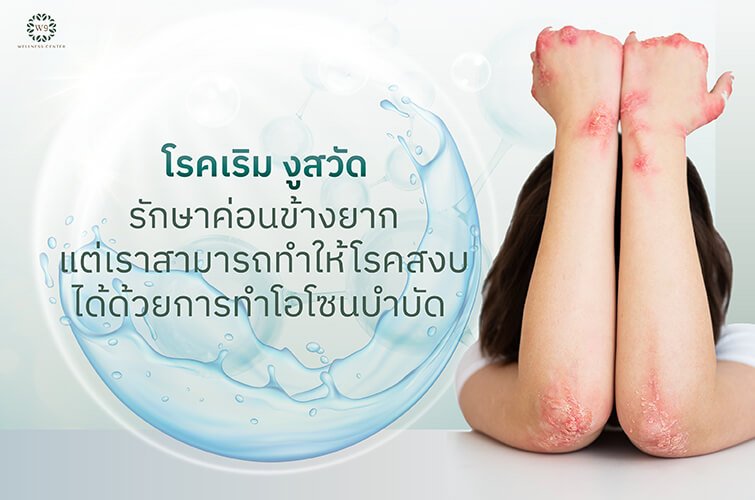 can glutathione kill herpes Glutathione: The Master Antioxidant Core Med Science Glutathione is one of the